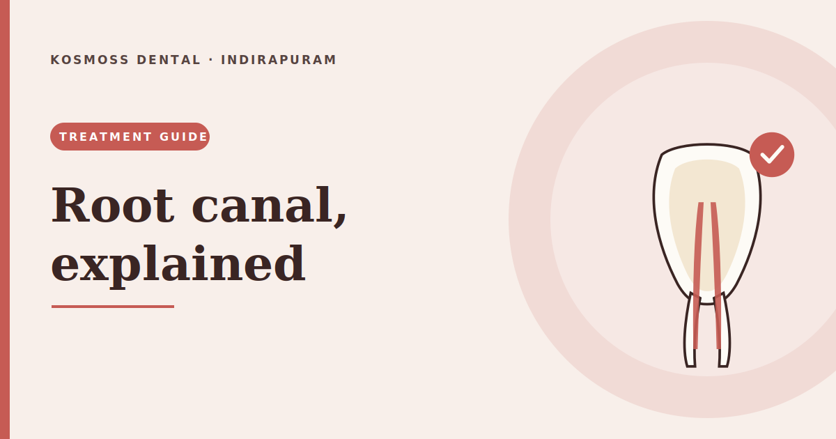 Root canal treatment explained, without the fear — Kosmoss Dental, Indirapuram